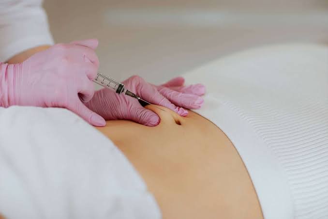 Carboxiterapia corporal