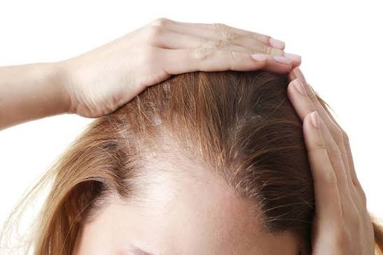 Cabello fino o debilitado