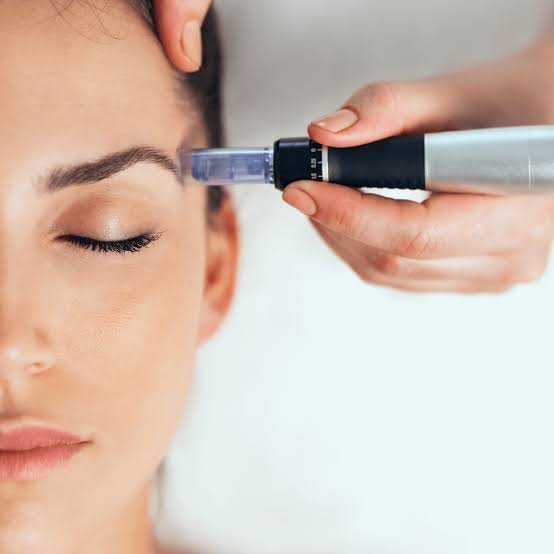 Dermapen (microneedling)