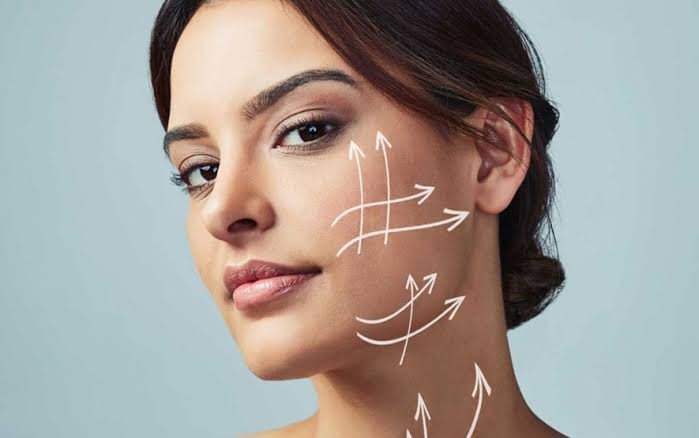 Endoláser (Endolifting®)
