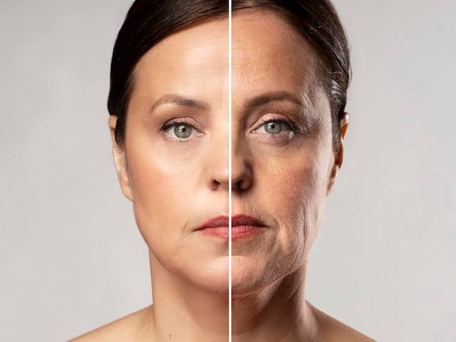 FLACIDEZ FACIAL
