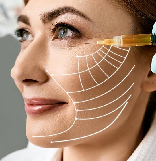 Lipofilling facial