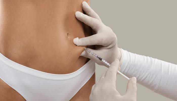 Mesoterapia corporal