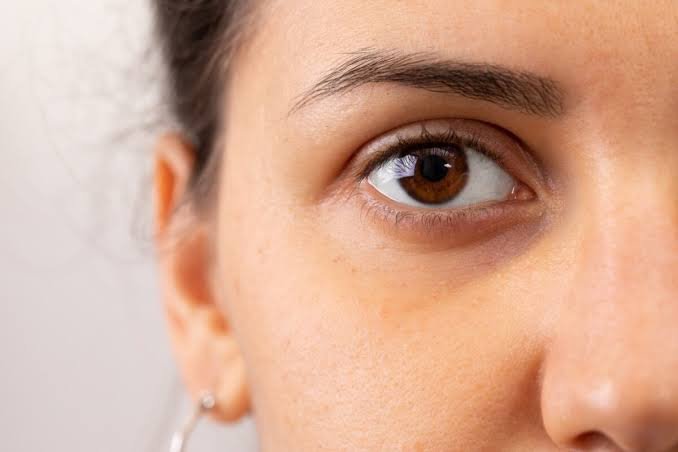 Ojeras